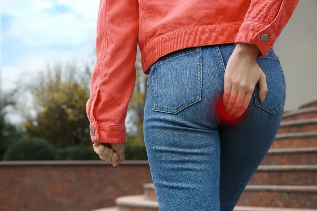 Como tratar a fístula perianal?