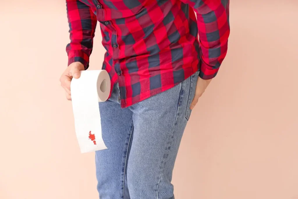 Sangramento Anal: O Que Pode Ser e Quando Preocupar-se